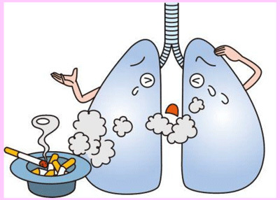 COPDの主な原因は、タバコ!