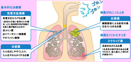 COPDの治療に使う薬剤